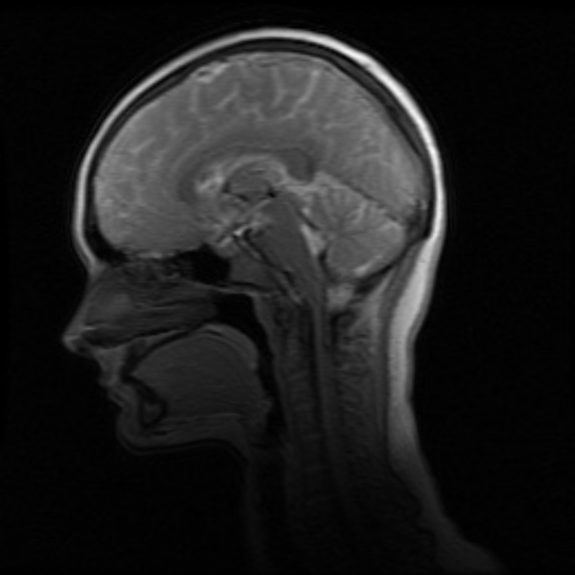 Interactive Brain Map